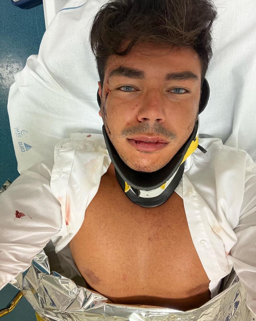 Quartu, influencer pestato dal branco per rubargli un orologio da 400 euro