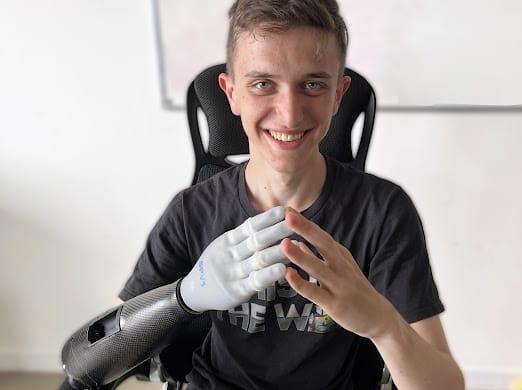 Maranello. Michele ha coronato il suo sogn: otrà avere una mano bionica