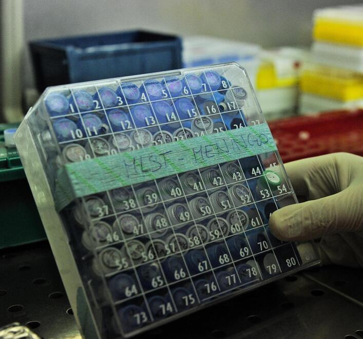 Giovane ricoverato per meningite: appello a chi era al Fuori Orario