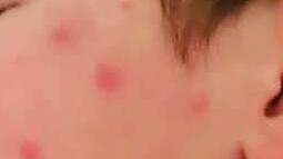 «Troppe zanzare, i nostri figli in pericolo»