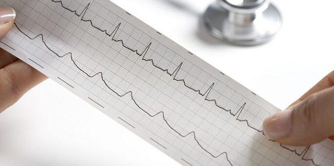 Sassari, l'odissea di una diabetica: «Visita cardiologica nel 2025 e così resterò senza patente» 