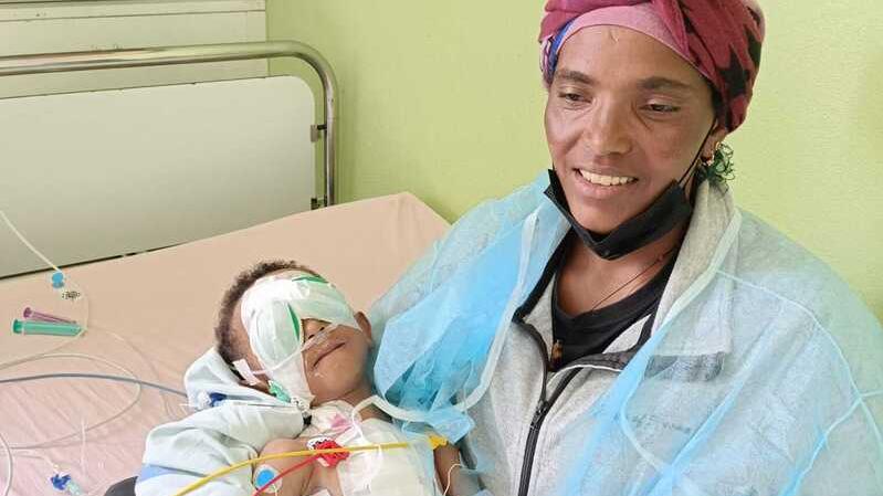 La bambina operata in braccio alla madre