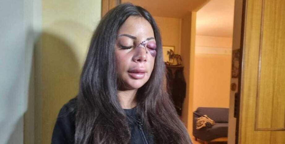 Aggressione a Martina Mucci. L’ex fidanzato va a processo<br>
