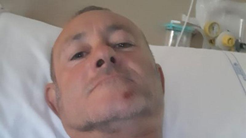 Con la moto contro un cinghiale. «Potevo morire, è andata bene»<br>