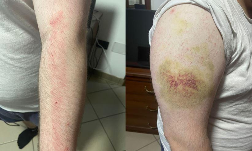 Ferrara, picchiati dai compagni di classe: due ragazzini cambiano scuola