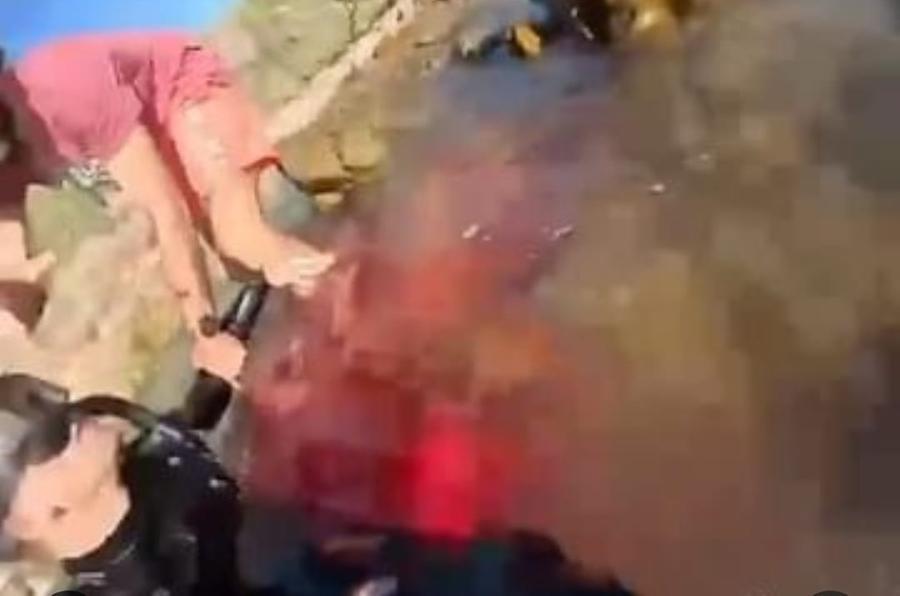 Attaccato da uno squalo perde una gamba