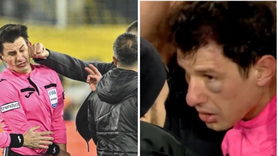 
	L'arbitro aggredito nella gara del campionato turco

