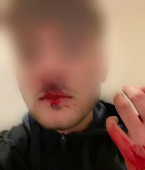 Due minorenni rapinati con un coltello a Modena Est