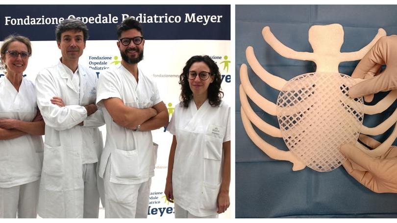 All’ospedale pediatrico Meyer di Firenze impiantata la prima protesi 3D riassorbibile in Europa