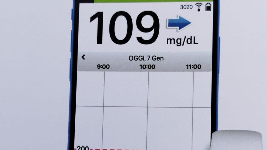 Diabete, primi sensori sottocutanei impiantati a Nuoro