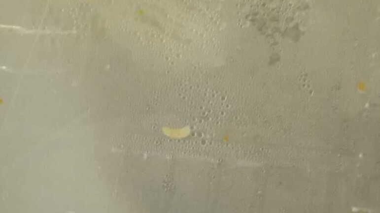 Un paziente a Modena: «Ho trovato una larva nella zuppa dell’ospedale»<br type="_moz" />
