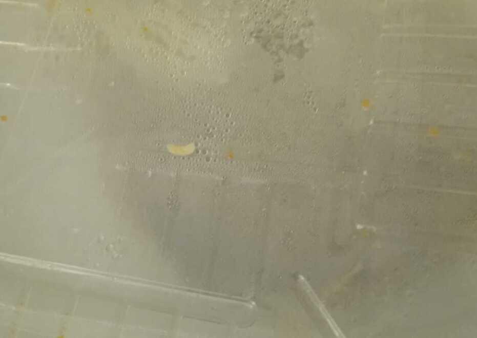 «Ospedale, nessuna larva nel piatto. Era una radichetta dei fagioli»<br>
