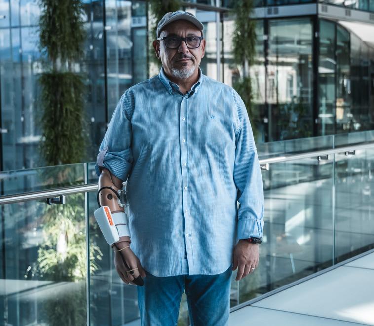 Fabrizio  Fidati con la protesi