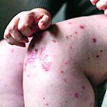 Reggio Emilia, invalido a rischio sfratto “Aiutate mio padre”