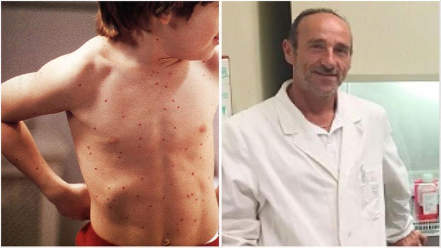 
	Un bambino col morbillo e il virologo Mauro Pistello

