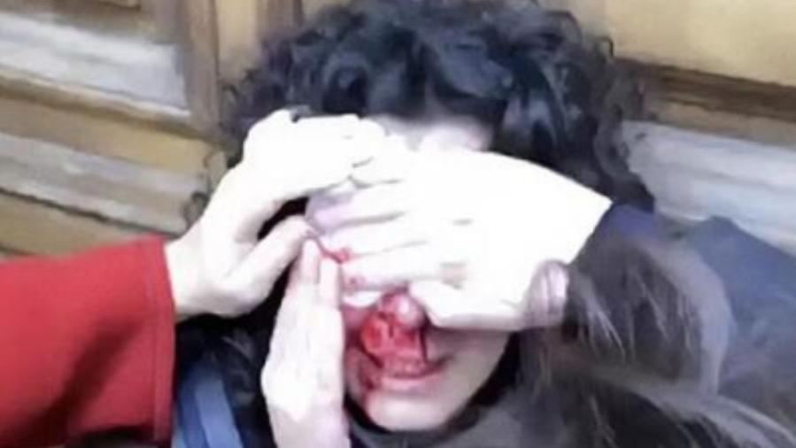 
	Maria col volto ricoperto di sangue dopo essere stata colpita durante il corteo a Firenze

