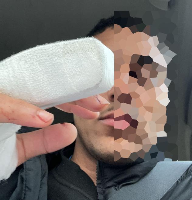Il calciatore del Serra accoltellato da un tifoso: «Ho temuto che volesse uccidermi»