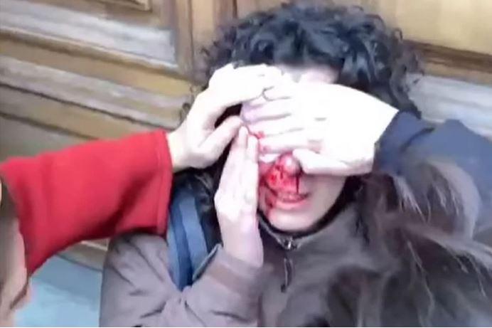 
	Una manifestante ferita al corteo di Firenze

