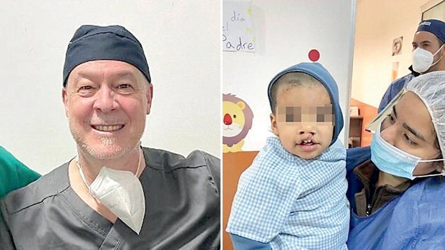 Gian Luca Gatti, il chirurgo che dà il sorriso ai bambini: 200 interventi al labbro leporino