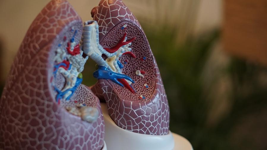 Tumore al polmone, la scoperta del Cnr-Itb di Pisa: «Un nuovo farmaco può fermarne la crescita». Cos’è l’Unesbulin e come funziona