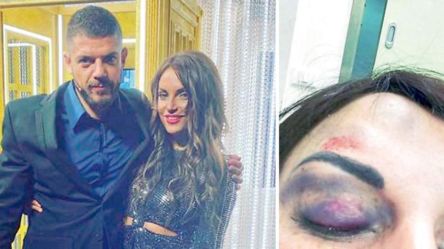 
	Giorgio Tambellini e Francesca De Andr&eacute;, a destra la&nbsp;foto del volto tumefatto che la donna pubblic&ograve; sui social

