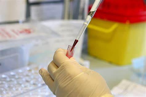 Screening neonatale, l’assessore Armando Bartolazzi: «Tempi più rapidi nell’acquisto delle forniture»