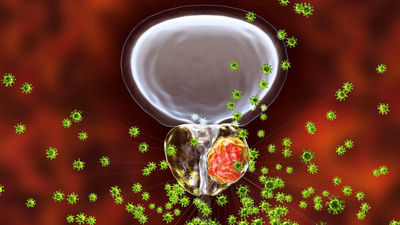 Tumore alla prostata, ok a un nuovo radiofarmaco prodotto a Pisa: le azioni che può svolgere