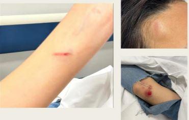 Commenta su Instagram la foto di un ragazzo, sedicenne pestata da due coetanee a Cagliari