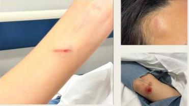 Commenta su Instagram la foto di un ragazzo, sedicenne pestata da due coetanee a Cagliari