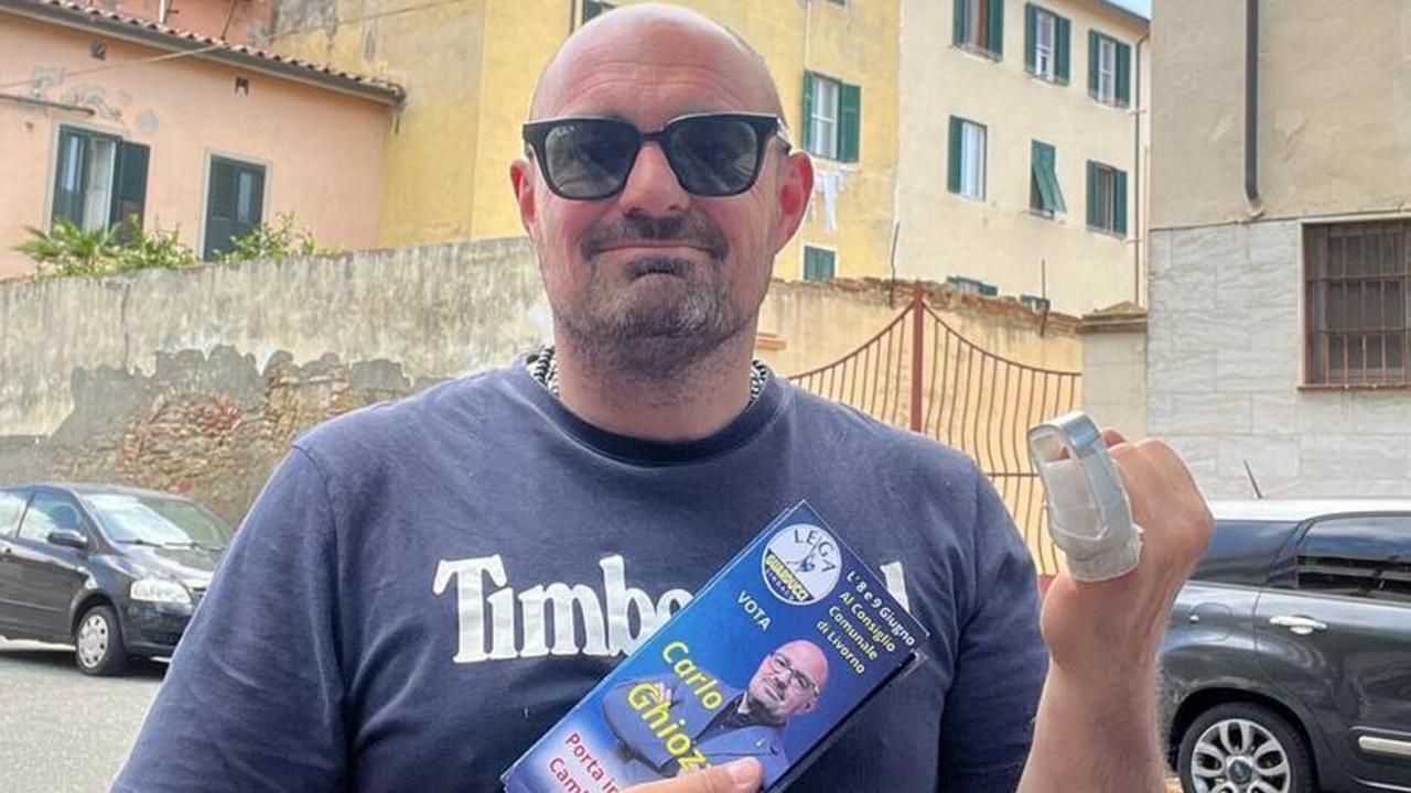 Carlo Ghiozzi mostra il dito lesionato e steccato