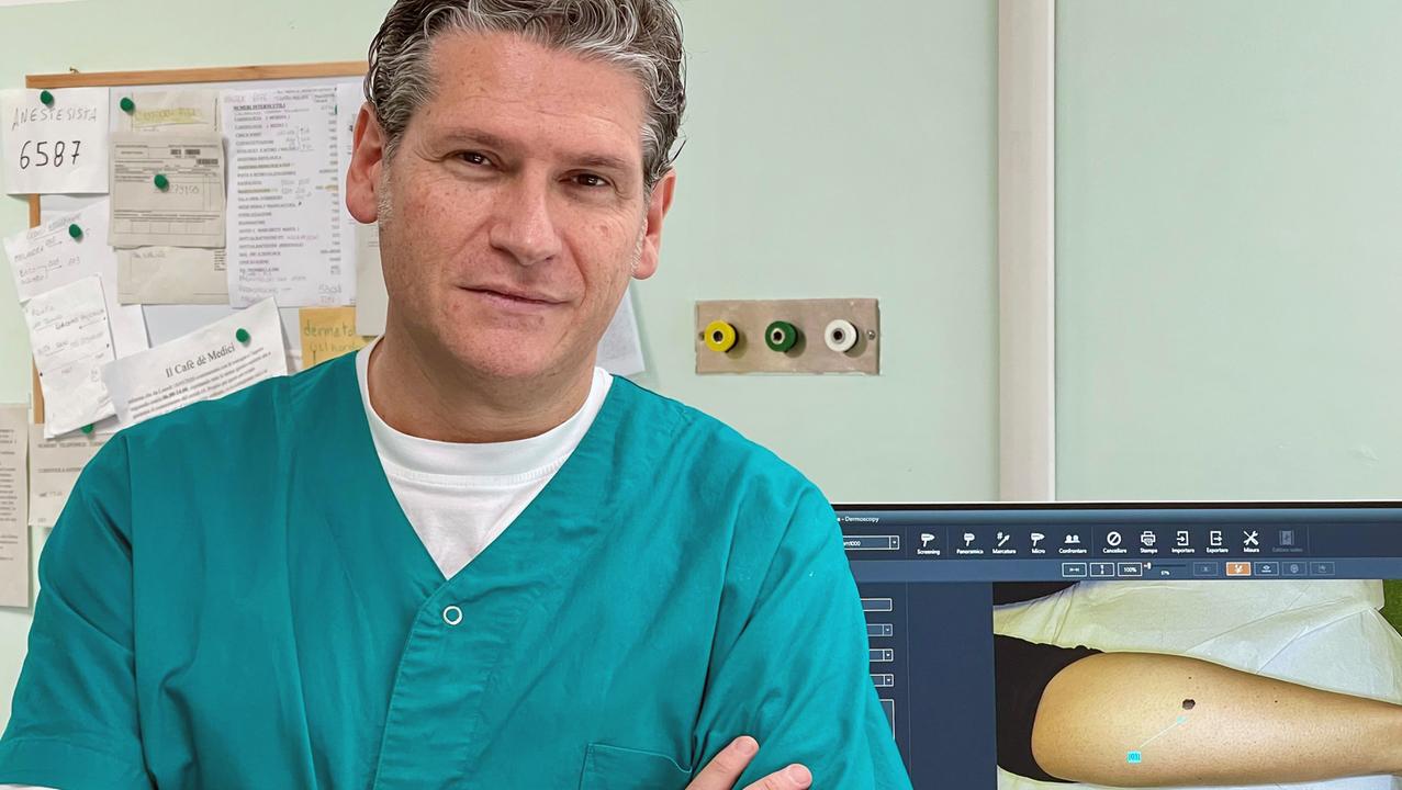 Melanoma, 400 casi in un anno a Livorno. Giovanni Bagnoni: «Ecco come si può prevenire» – Video