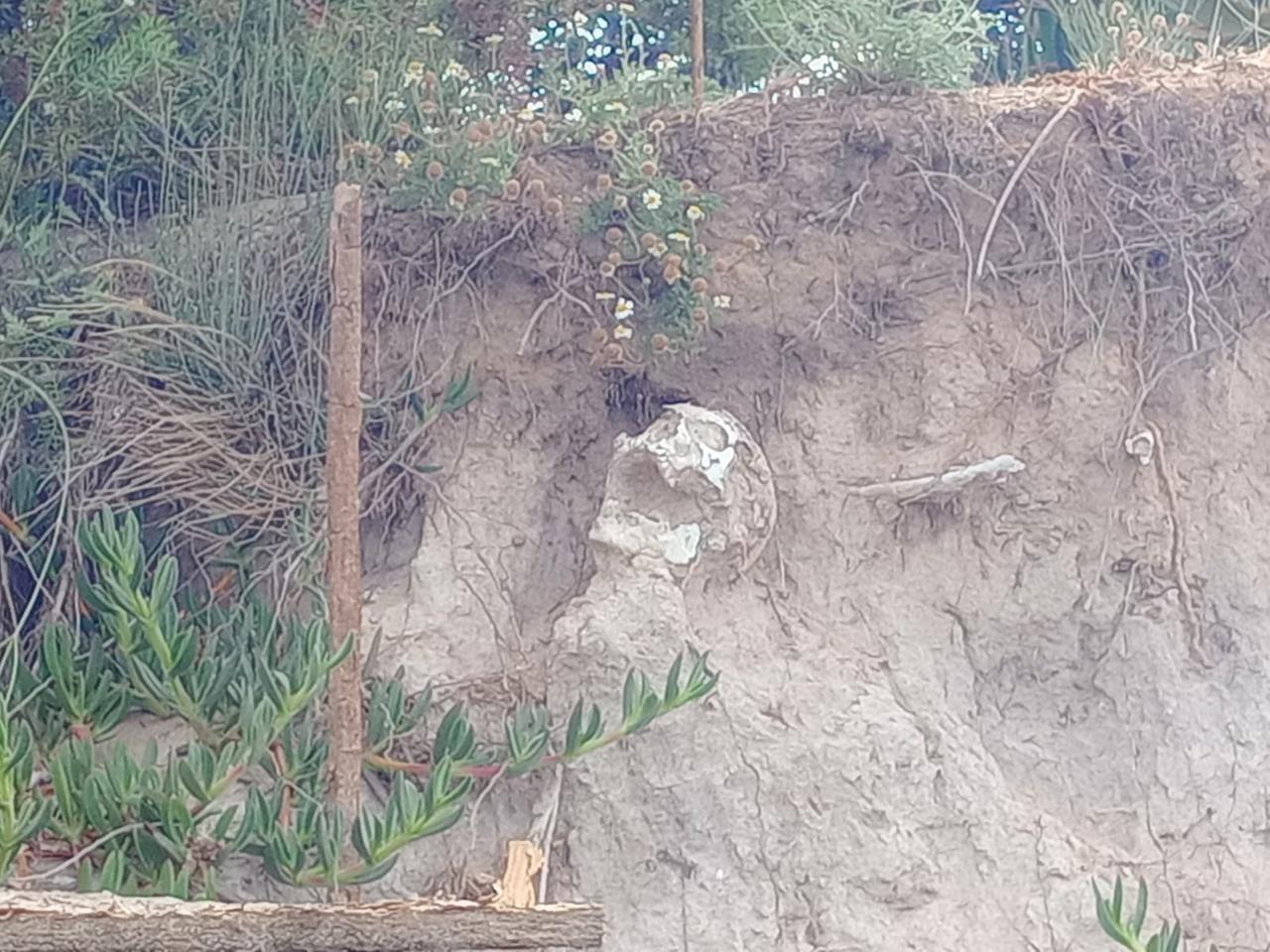 
	Lo scheletro emerso con l'erosione della duna a Su Pallosu

