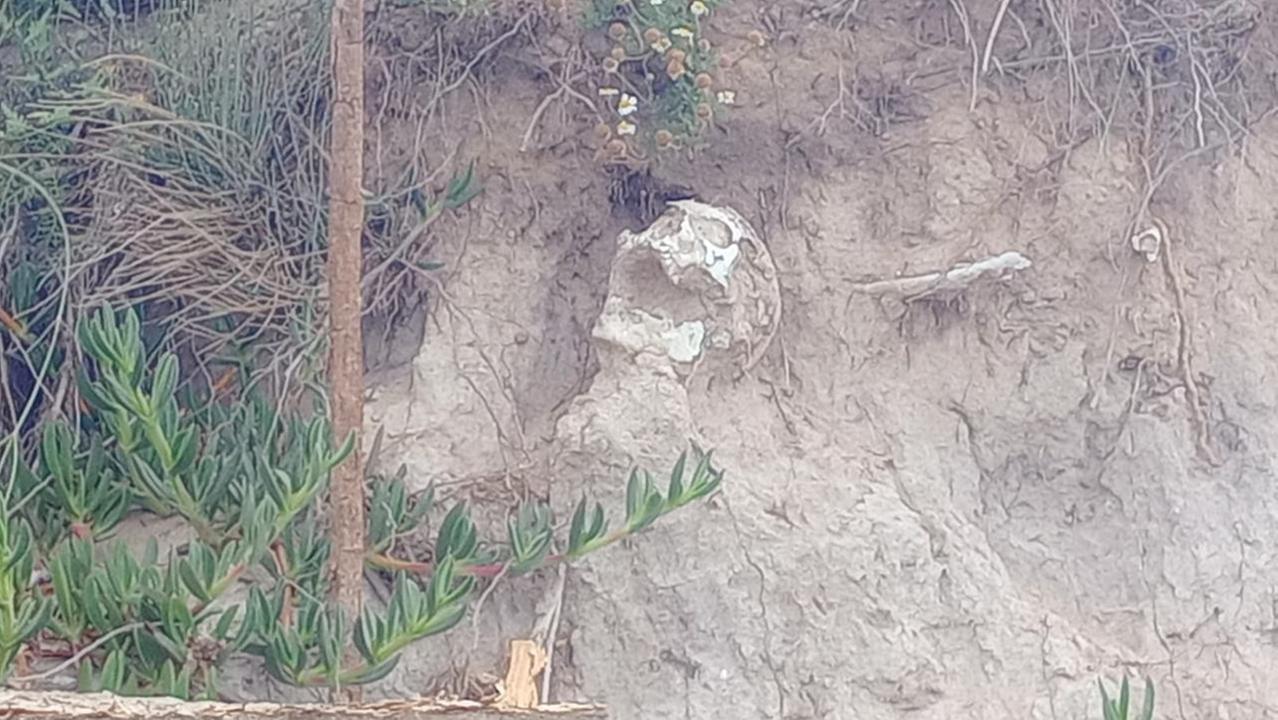 Lo scheletro emerso con l'erosione della duna a Su Pallosu