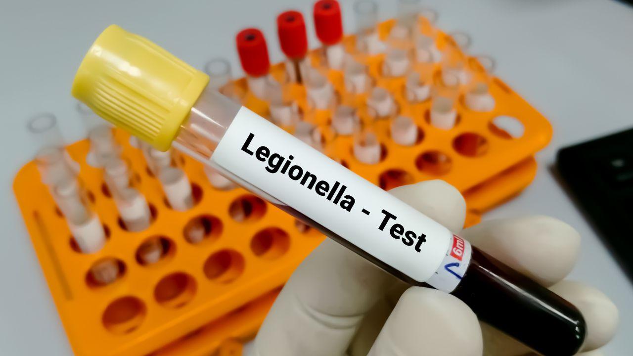 Livorno, il Comune: «Legionella nelle docce calde di alcuni stabilimenti balneari»