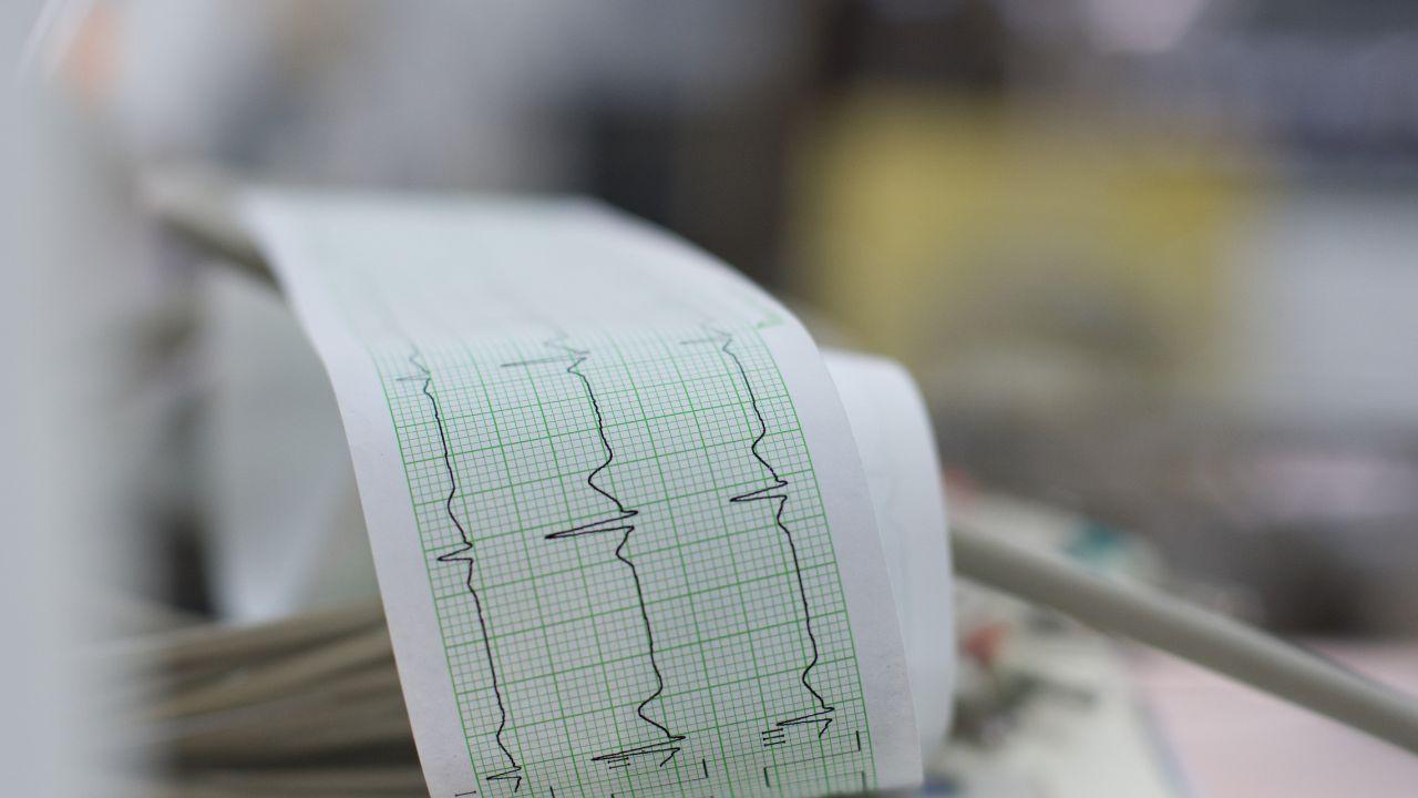 Infarto, svolta nell’emergenza: team salva-vita in 14 ospedali toscani