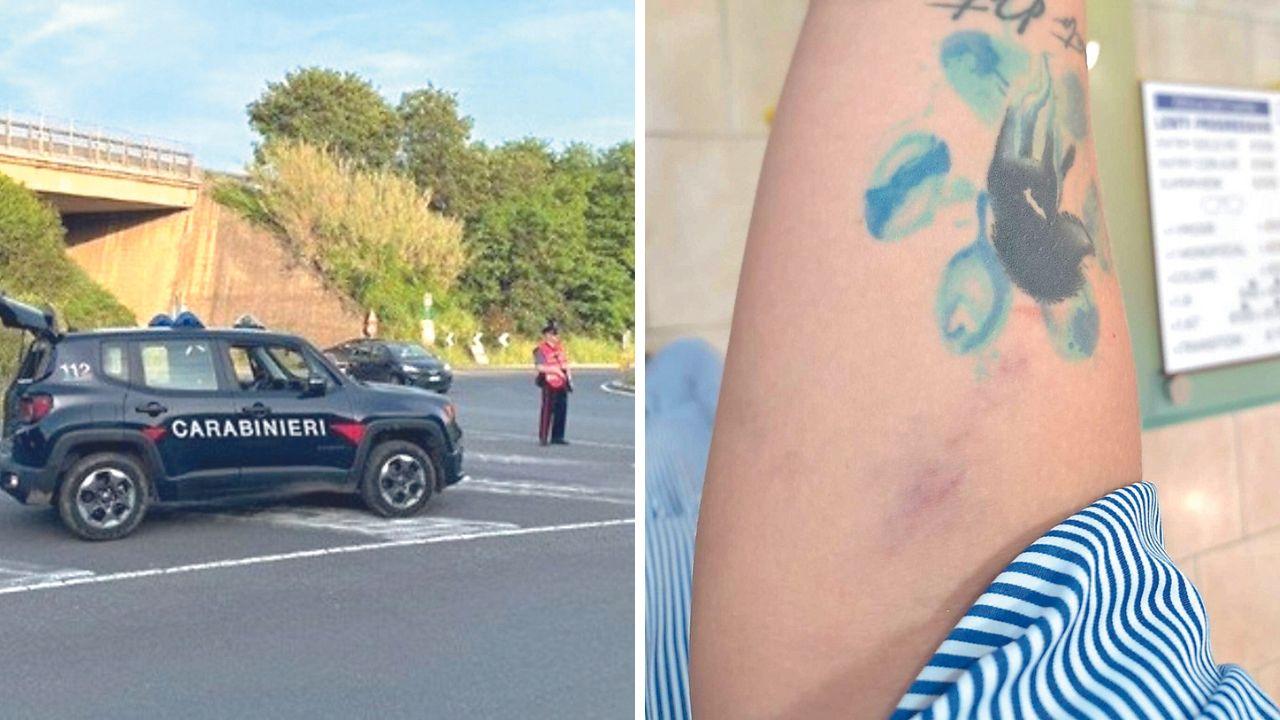 A sinistra una pattuglia dei carabinieri di Cecina, a destra l’ematoma sul braccio della donna