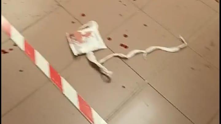 Tracce di sangue sul pavimento del pronto soccorso dopo la rissa