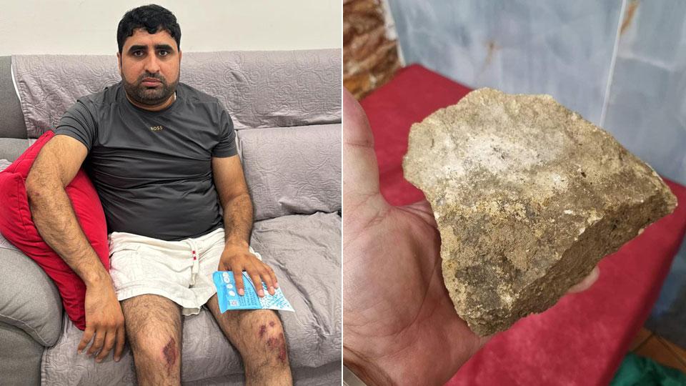 Muhammad Anar con le ginocchia ferite
