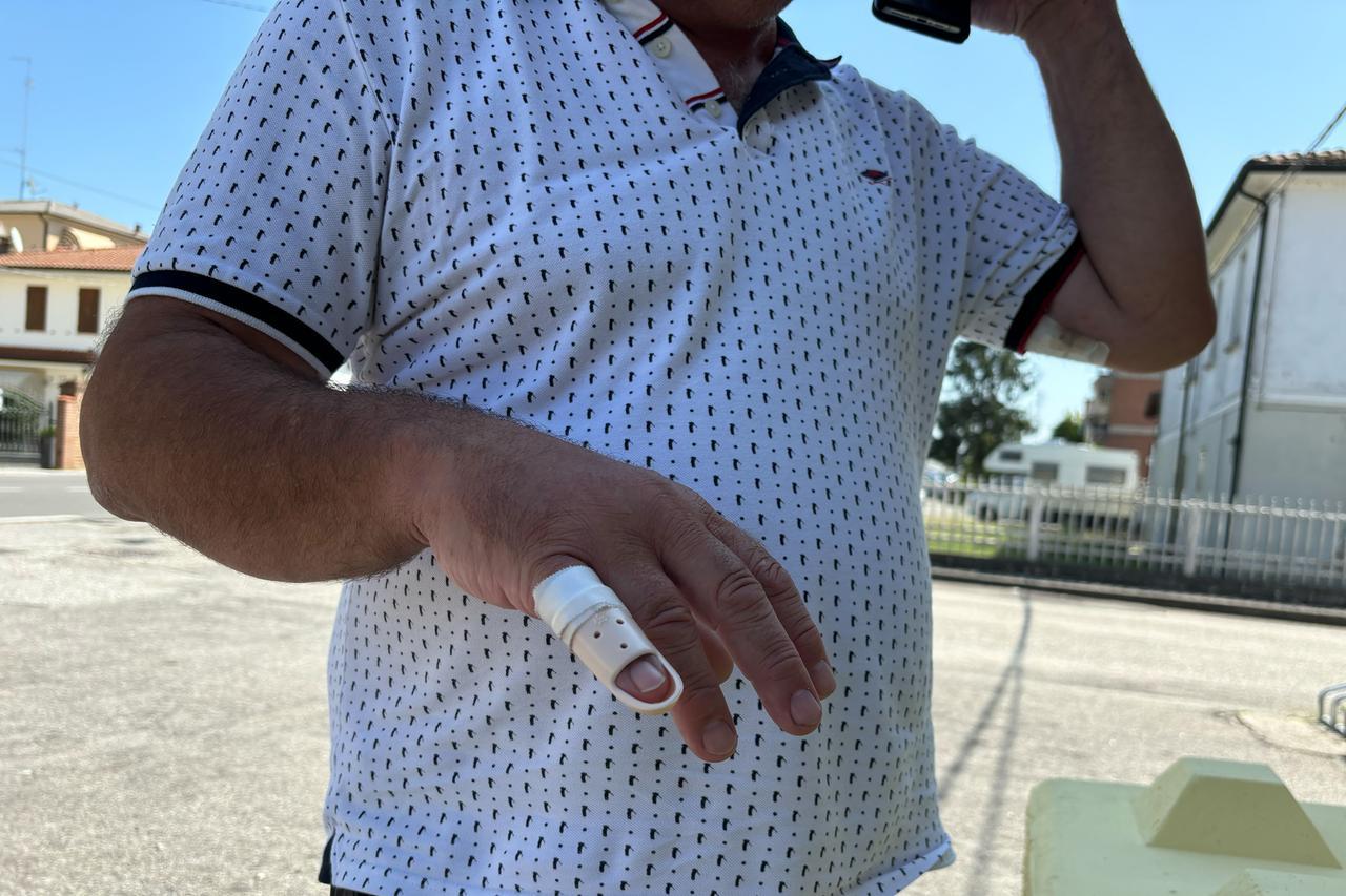 Pontelagoscuro, sfregiato da uno sconosciuto: arrestato trentenne