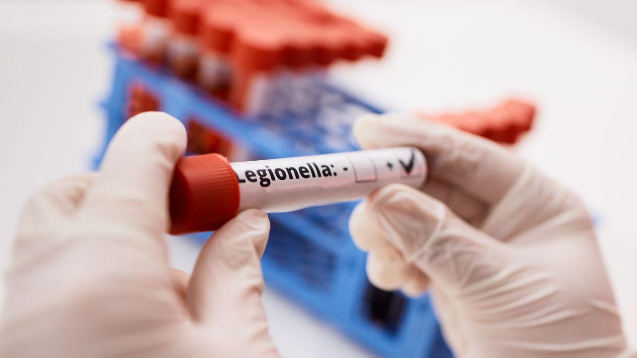 Collesalvetti, caso di legionella in una scuola: via ai test di controllo