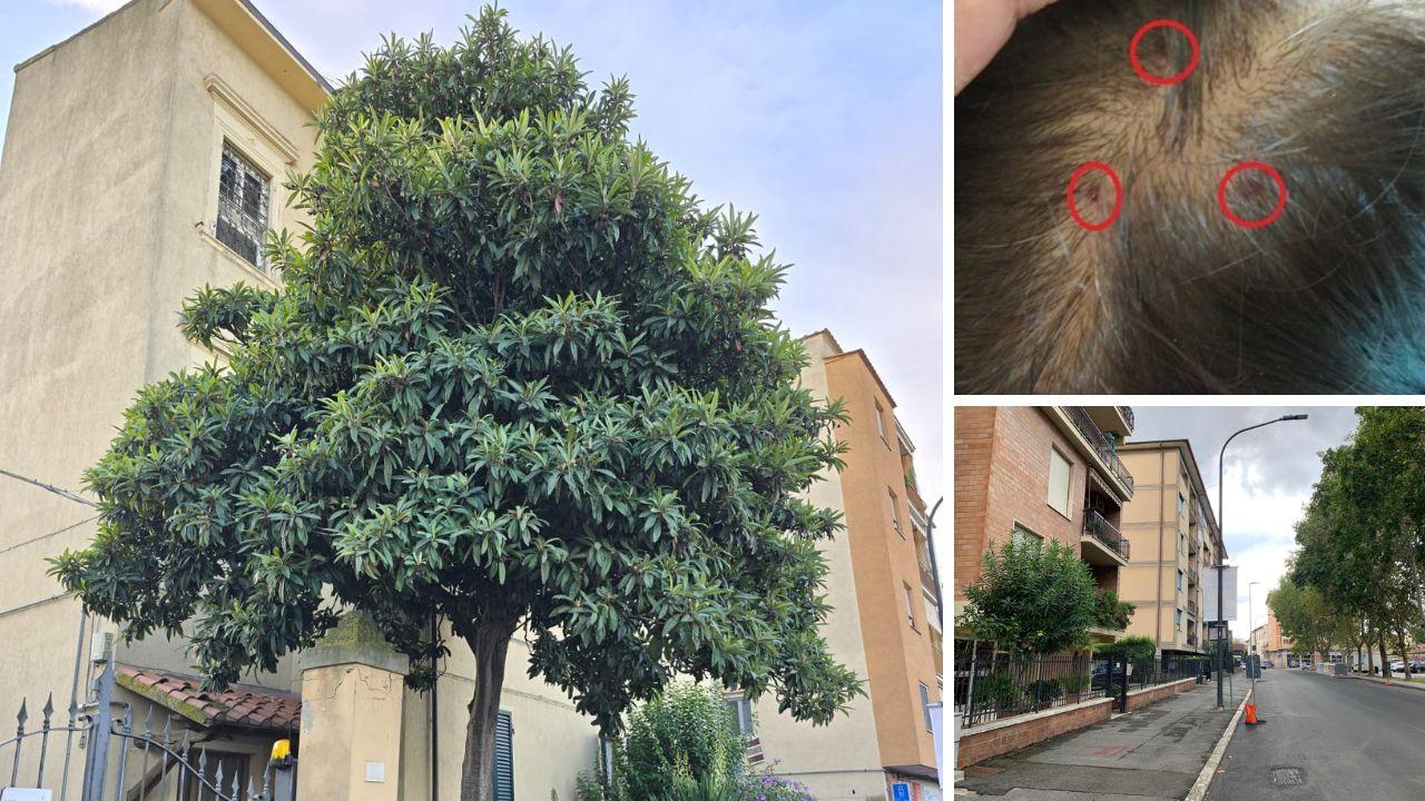 
	Il nespolo, le ferite che ha riportato in testa e la strada dove abita

