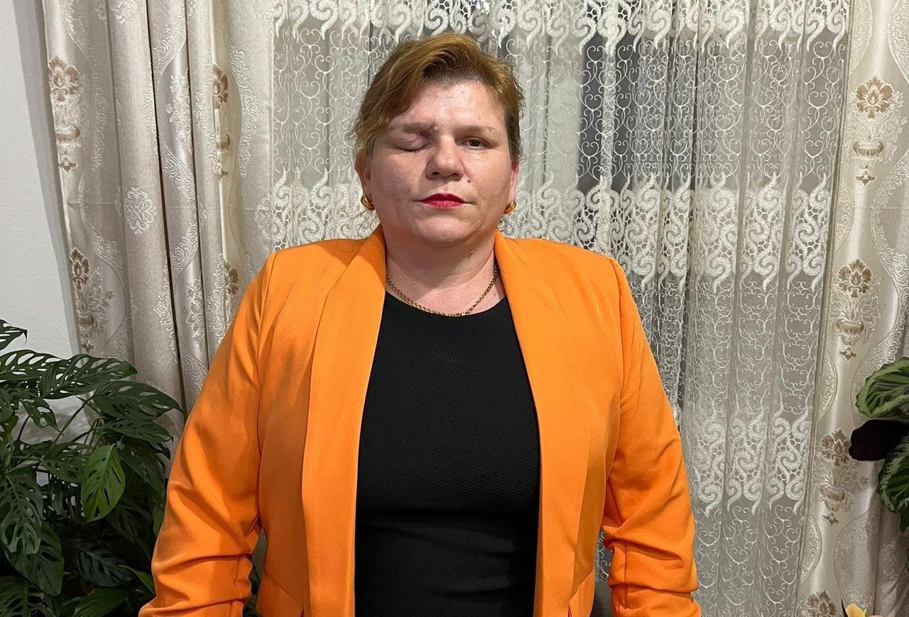 
	Petronela Codreanu ha perso la vista all&rsquo;occhio destro

