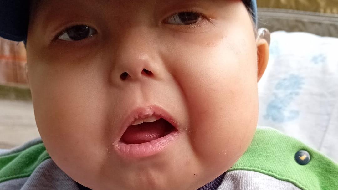 Montagna in lutto, il piccolo Elia muore a 3 anni