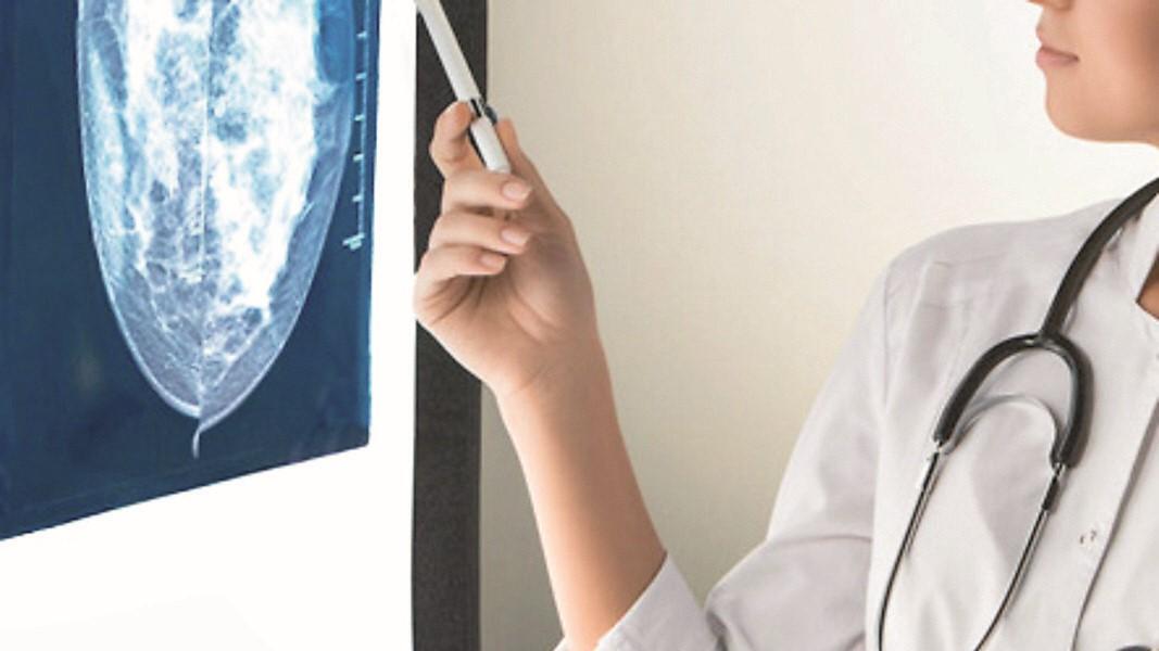 Tumore al seno, Aou di Sassari protagonista con oltre 300 interventi e 7mila prestazioni