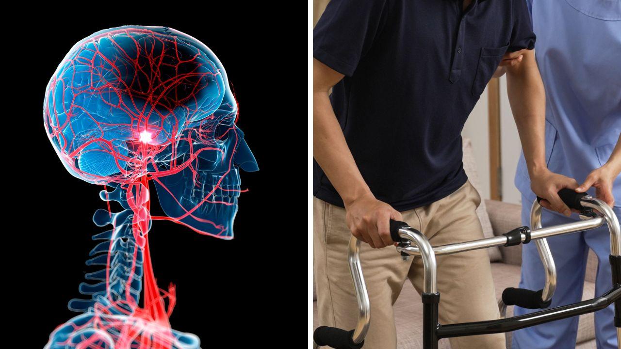 Ictus, in Toscana 10mila casi all’anno: i sintomi e come imparare a riconoscerli