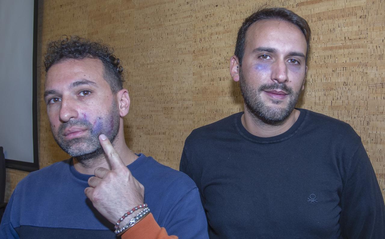 
	Maurizio Alaimo e Vincenzo Giambruno mostrano i segni dell'aggressione subita

