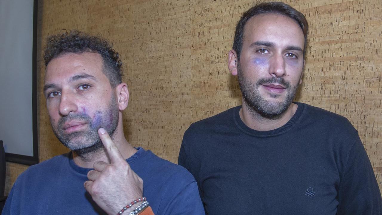 Maurizio Alaimo e Vincenzo Giambruno mostrano i segni dell'aggressione subita
