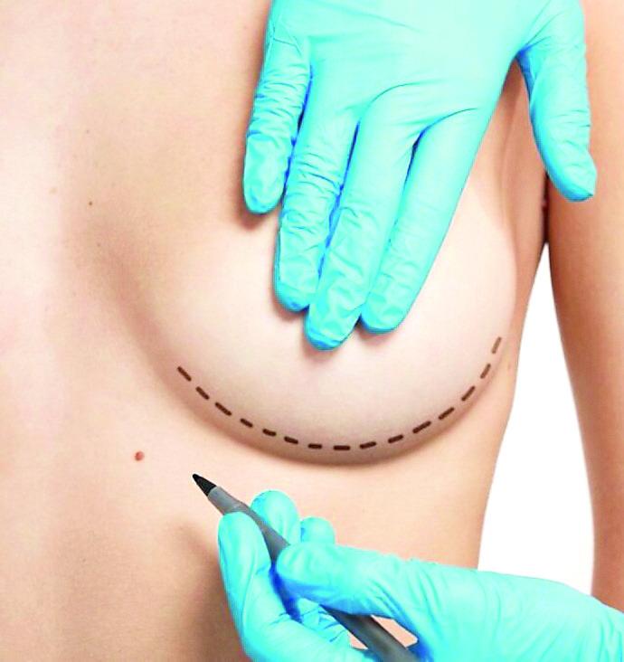 Nanni Campus: «Ma come si può scegliere un medico per un intervento di chirurgia estetica su Tik Tok?»