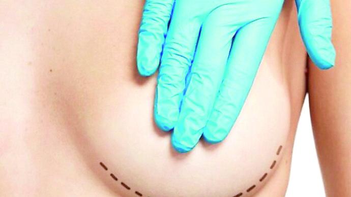 Nanni Campus: «Ma come si può scegliere un medico per un intervento di chirurgia estetica su Tik Tok?»