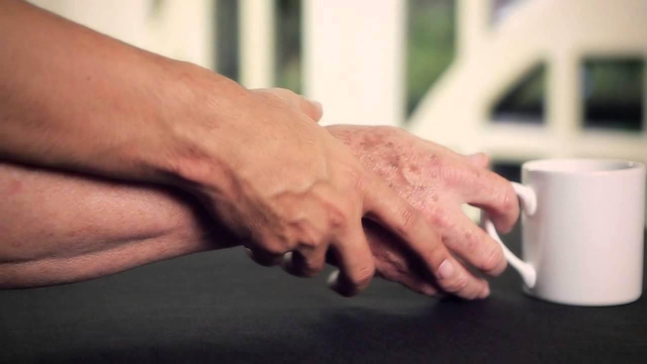 Sos medicine salvavita: quelle per il Parkinson introvabili in farmacia